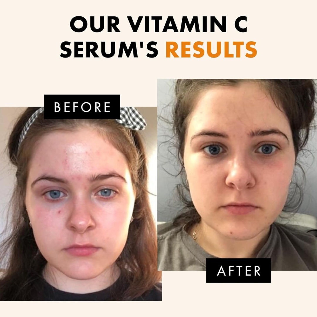 ECLAT Glow Up! Vitamin C Serum with Ferulic Acid & Vitamin E | Anti-Aging Brightening Serum 1 fl oz - Image 3